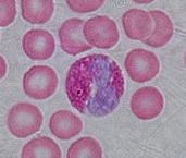 eosinfilo