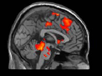 Respuesta cerebral en nios y jvenes agresivos