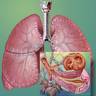 Enfermedad pulmonar obstructiva crnica