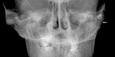 radiografas dentales