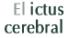 Ictus cerebral