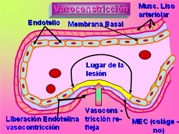 Vasoconstricción