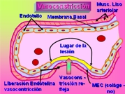 Vasoconstriccin